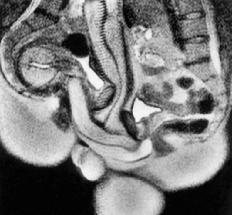 Japanski seks lutka porno